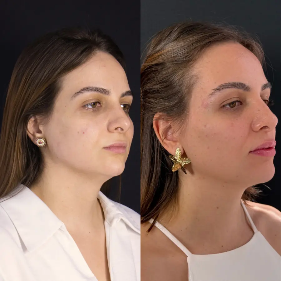 Antes e depois do tratamento — caso 2