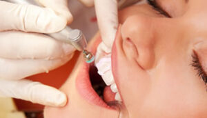 Procedimento Profilaxia Dental Dra Fernanda Fioroto